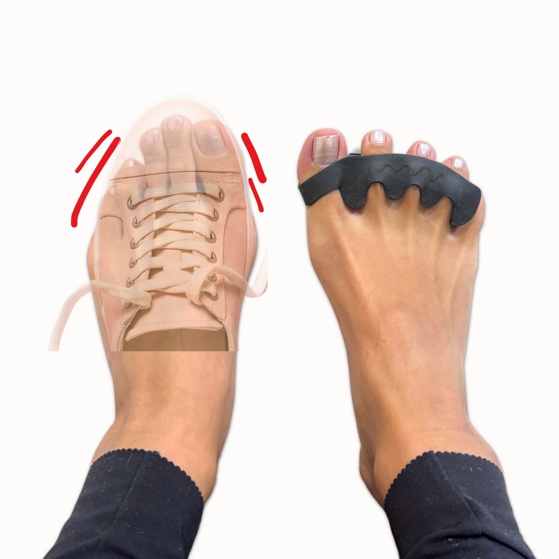 Left: toes pushed together by a tapered toe box. Right: toes spread with a Toe Spacer.